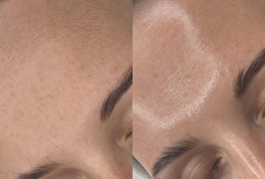 glass skin zabieg na twarz