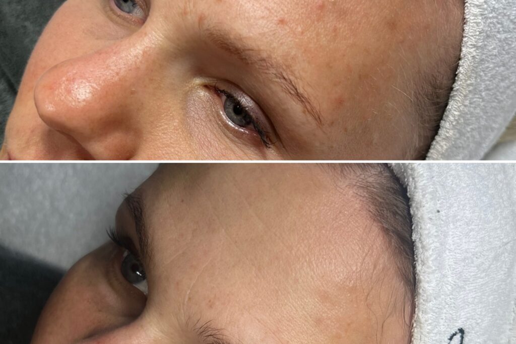 PLAN PIELĘGNACJI SKÓRY