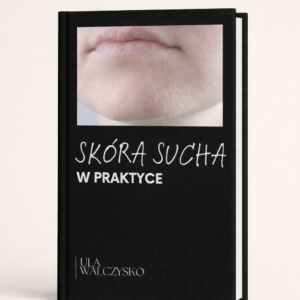 skóra sucha w praktyce