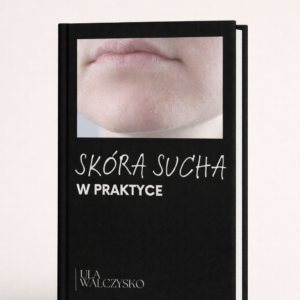 skóra sucha w praktyce